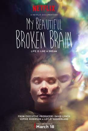 Filme My Beautiful Broken Brain 2016